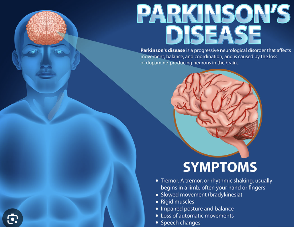 Parkinson’s Disease Detection
